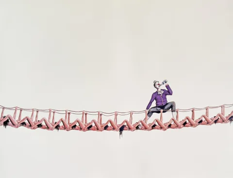 Umbilical Bridge